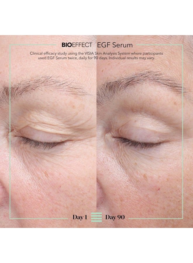 BIOEFFECT EGF Serum Treatment Duo with Hyaluronic Acid, Enhance Skin with Moisturizing, Firming, Wrinkle-Fighting Treatment for Face And Neck, Day And Night, Best Derma Roller Facial Serum - Image 3